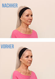 Facial Design (©Foto: d-aesthetic)